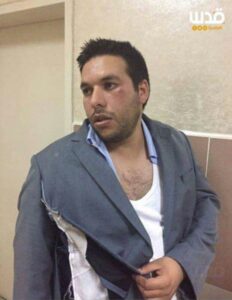 mohannad-karajah-attacked